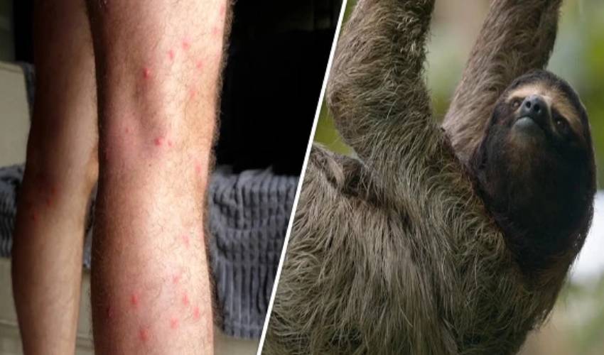 Scientists warn oropouche virus could have infected millions